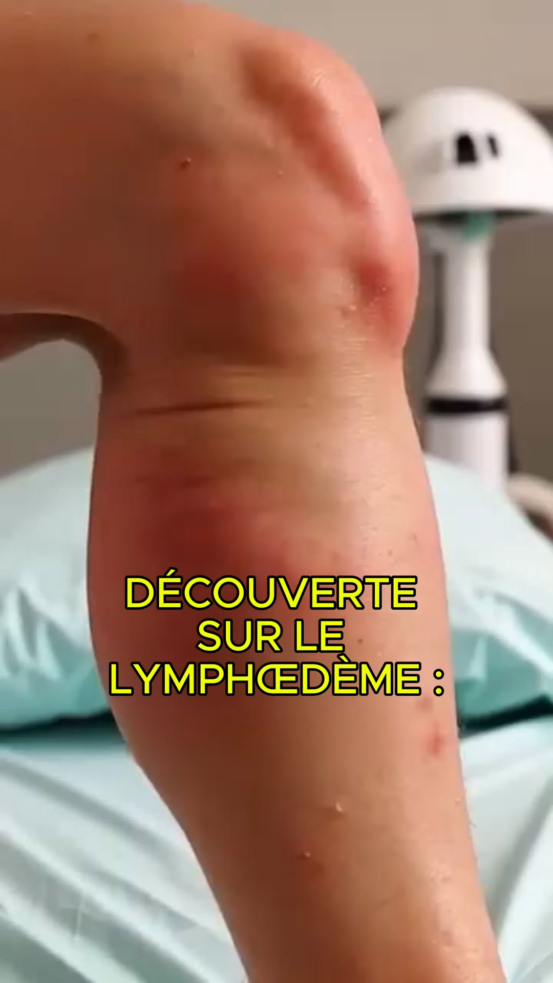 Les douleurs aux jambes et aux pieds, c’est du passé !