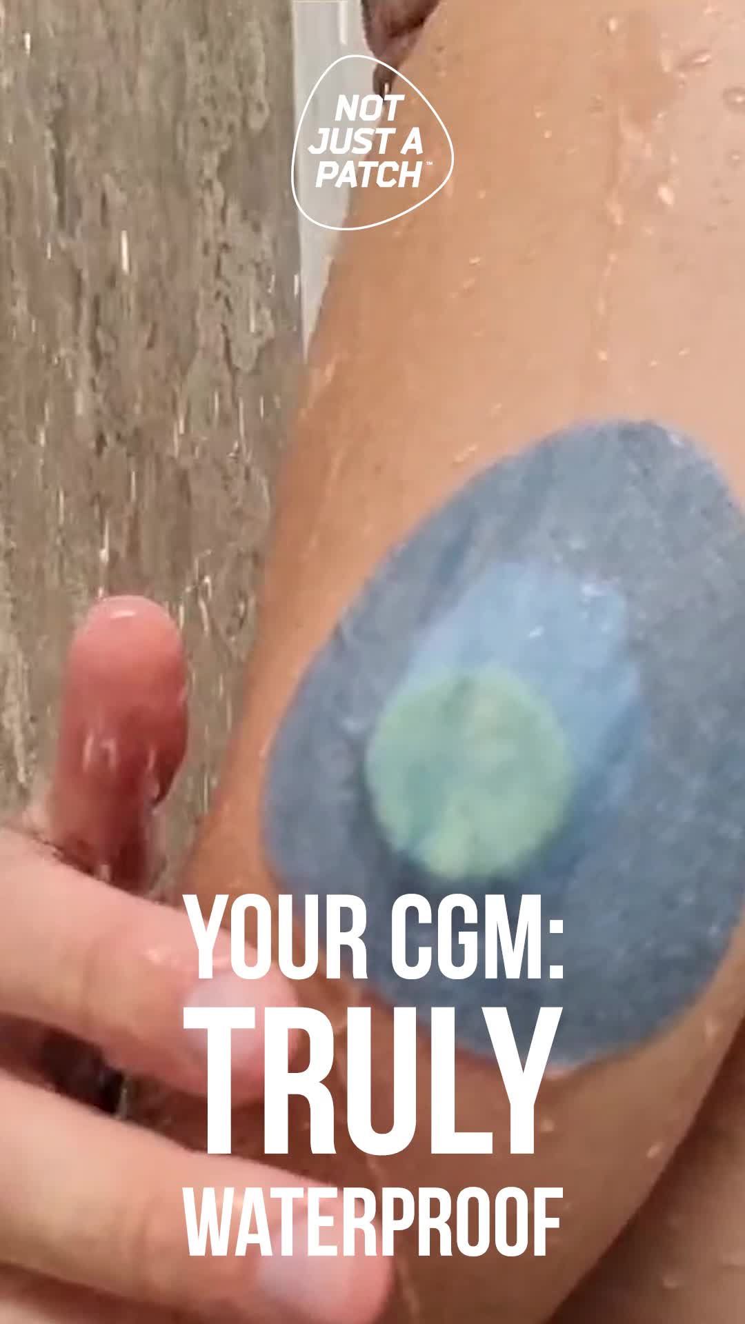 Unlock CGM Freedom