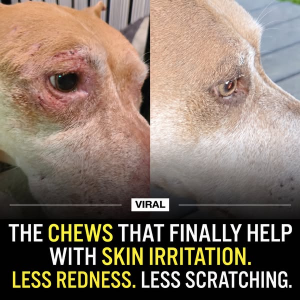 Calm the Skin. Stop the Scratch.