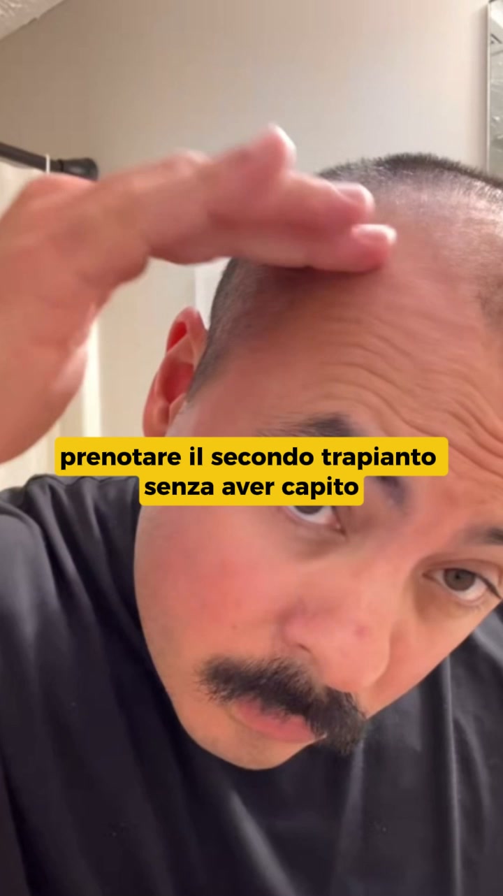 Cosa succede ai capelli che non trapiantano