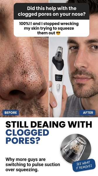 THE #1 PORE REMOVER MEN ARE SWITCHING TO