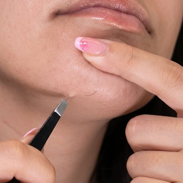 Read this if you want to get rid of chin hair