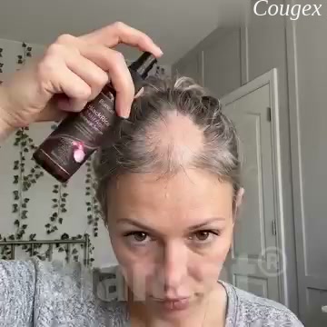 Seeing More Scalp Along Your Part?