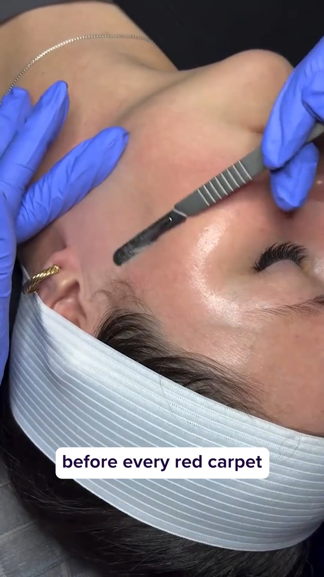 Easy At-Home Dermaplaning
