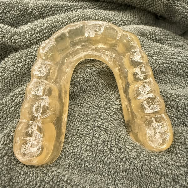 Read This If You Have TMJ