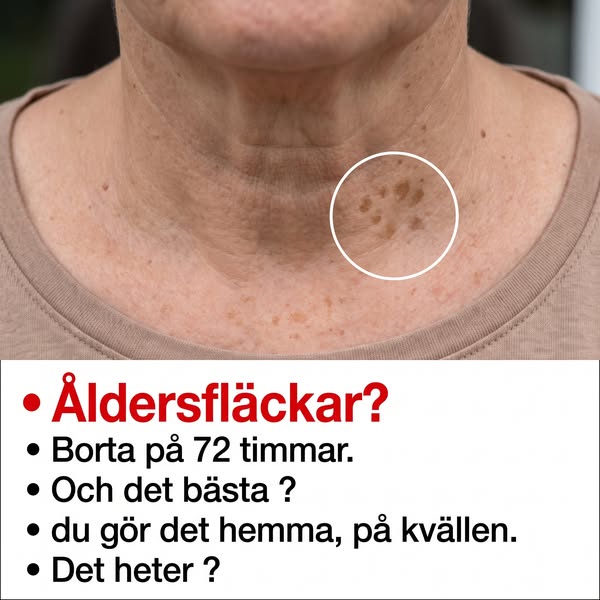 Åldersfläckar under lupp