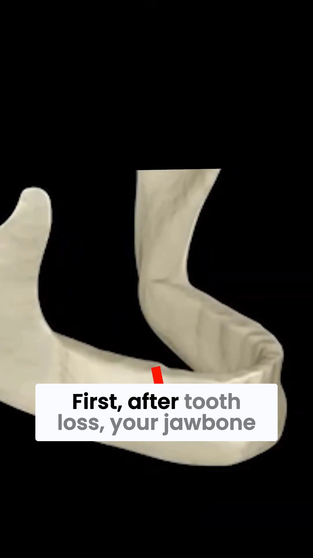 The 7-Day Hold Dentists Don’t Talk About
