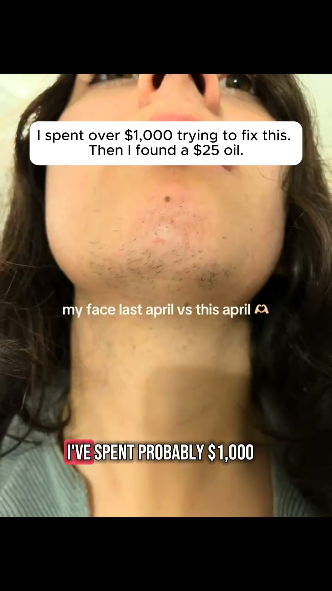 She Spent $1,000 Trying to Fix It. Then Found This for $25.