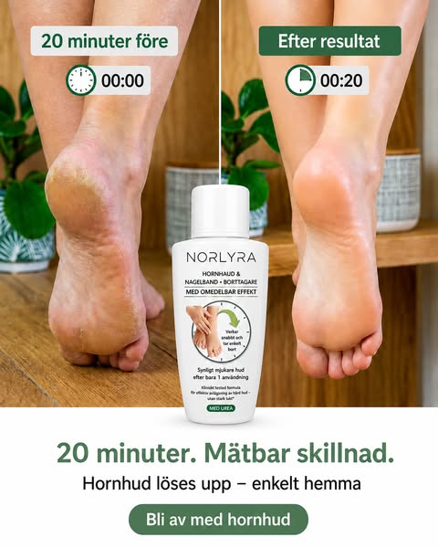 Mjuka fötter på 20 minuter