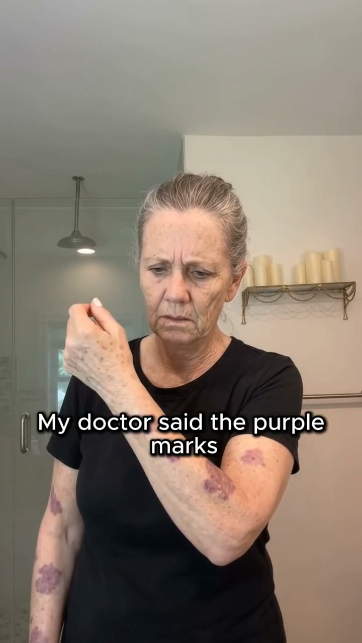 What Causes Purple Marks?