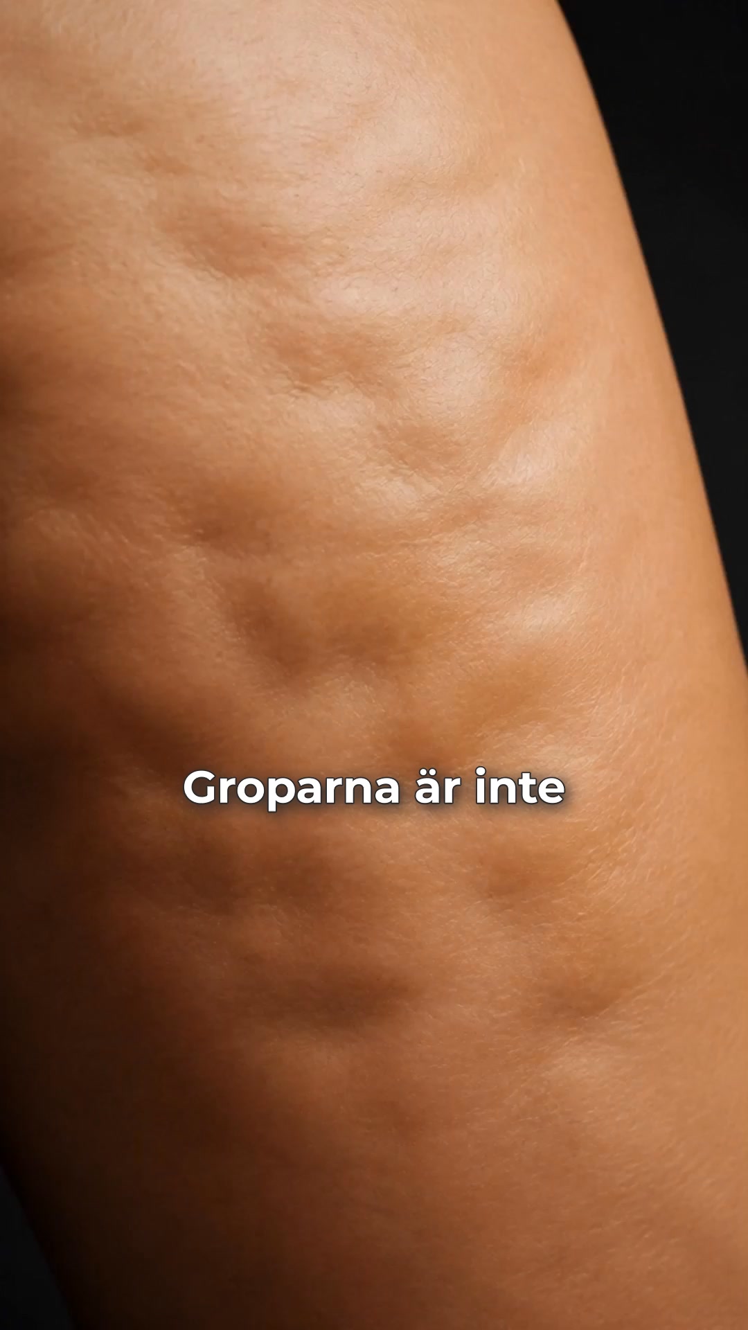 3 000 kr på klinik. Eller 10 min hemma.