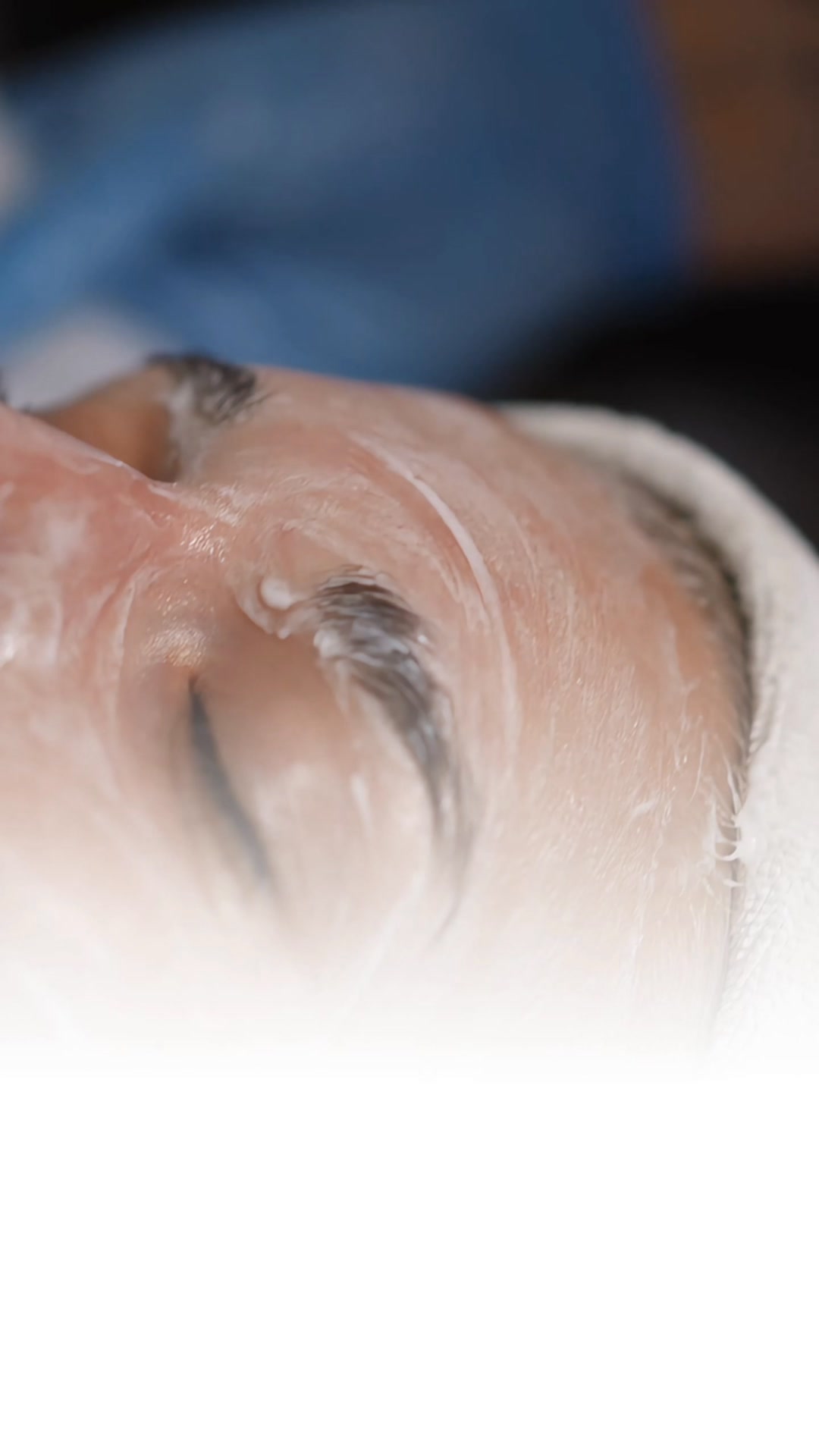 The 4D Peel Clinics Are Switching To