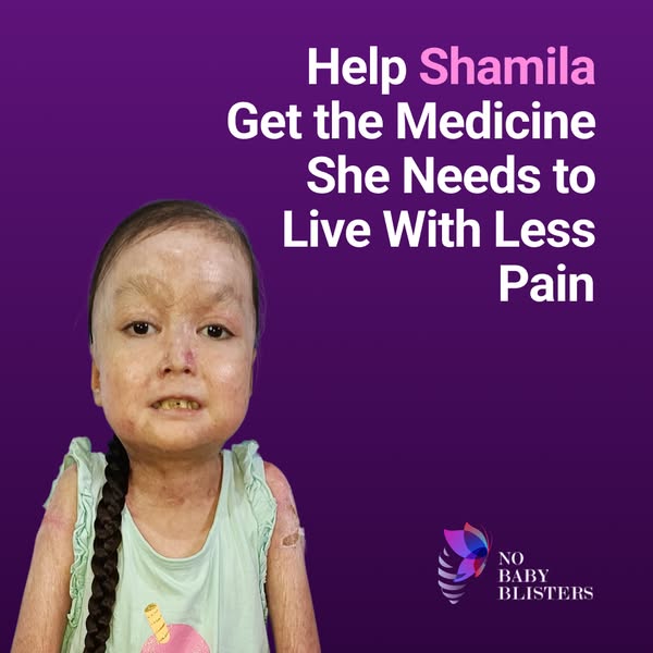 Shamila’s Skin Is Falling Off. Help Her.