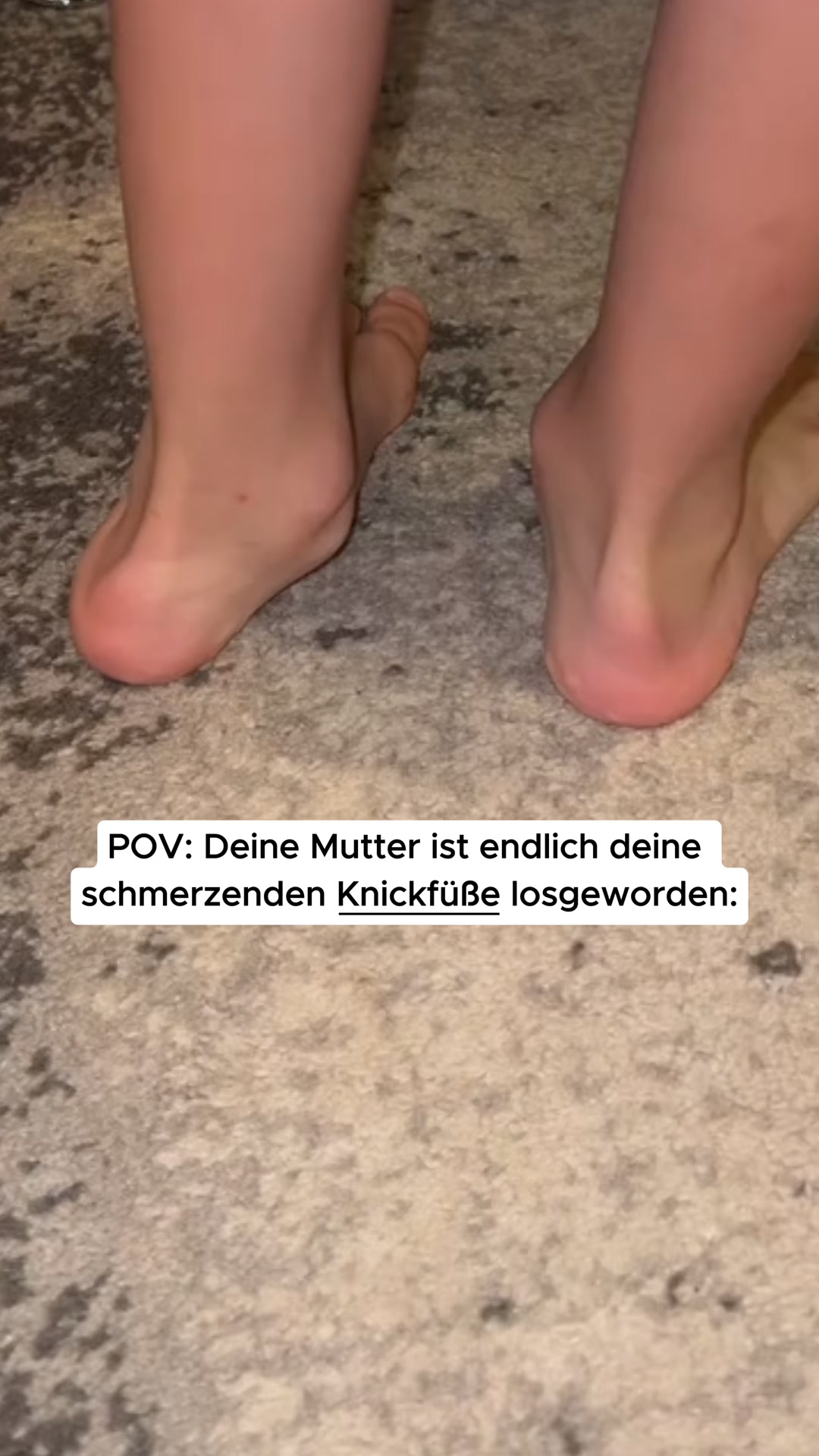 Plattfüße jetzt richtig unterstützen!