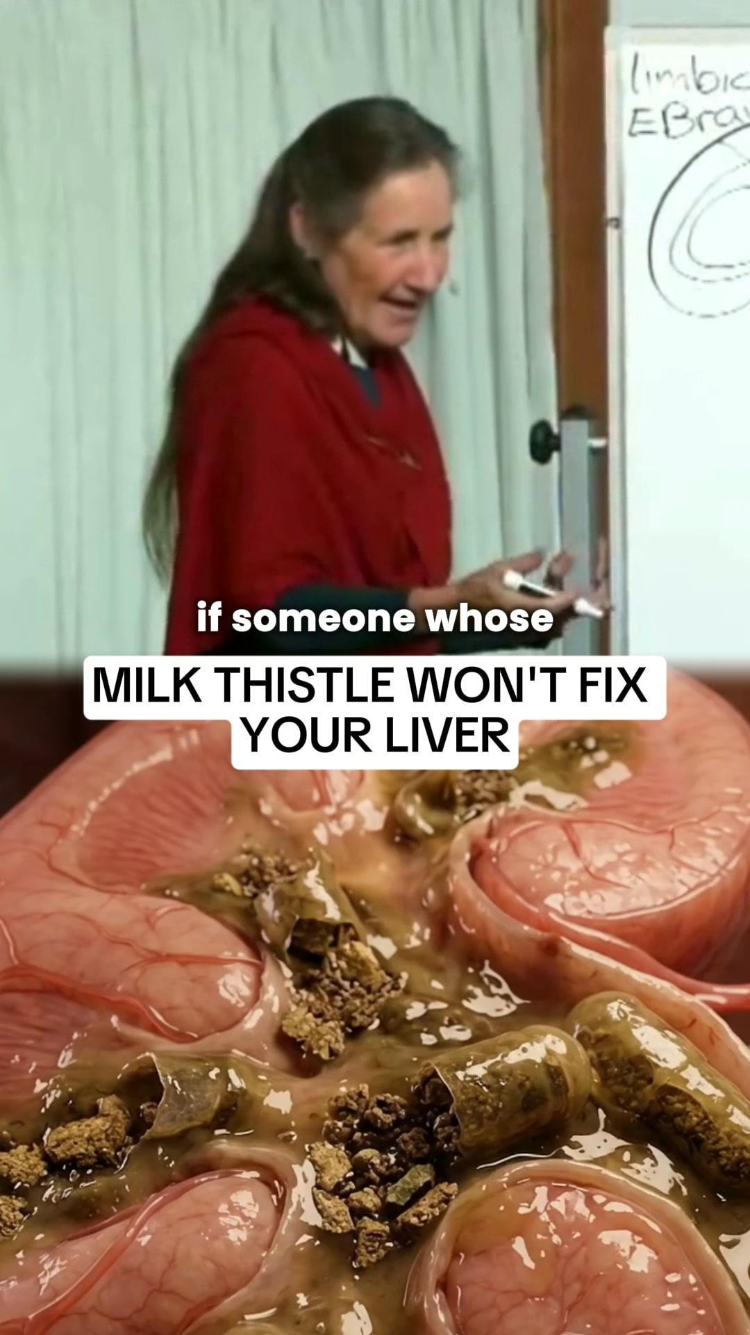 Don’t Blame Your Lifestyle — Fix The Lymphatic System First