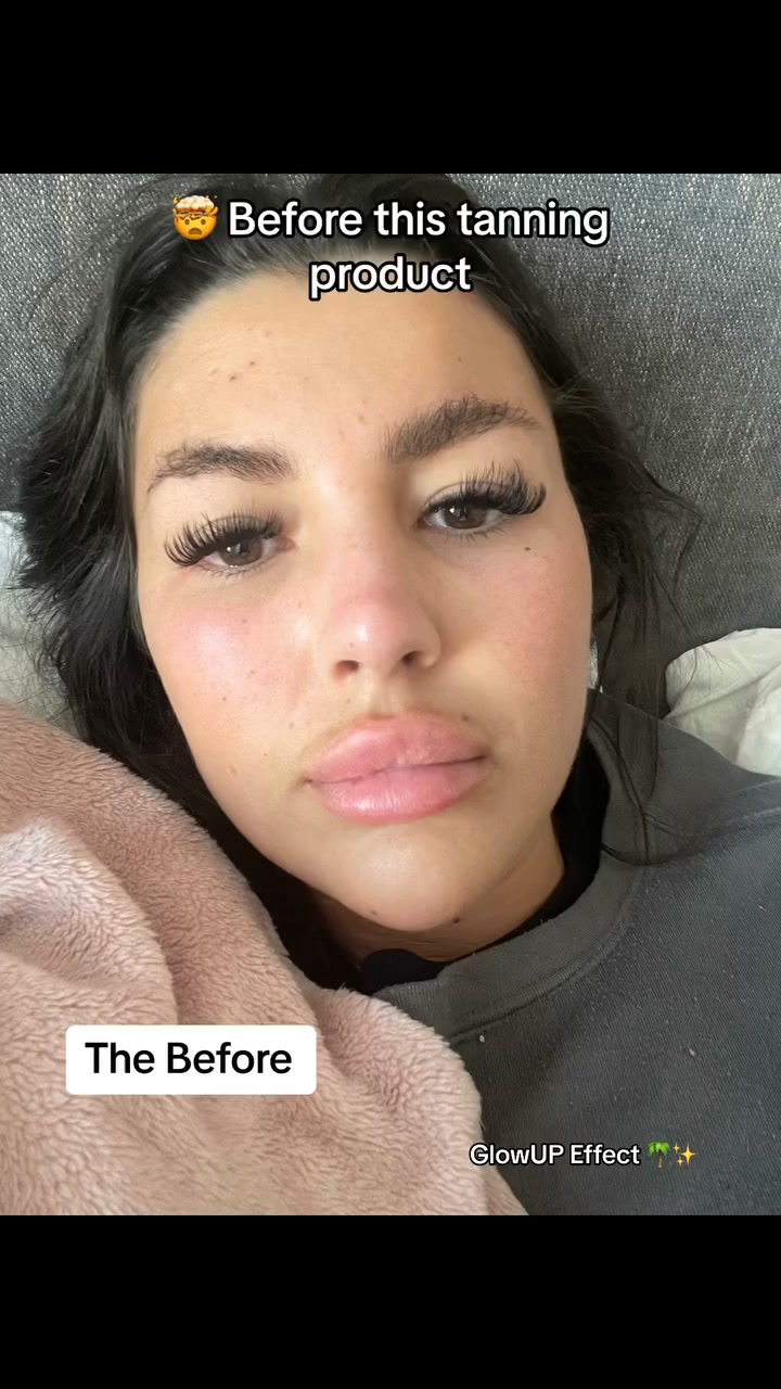 The Before The Glow Up