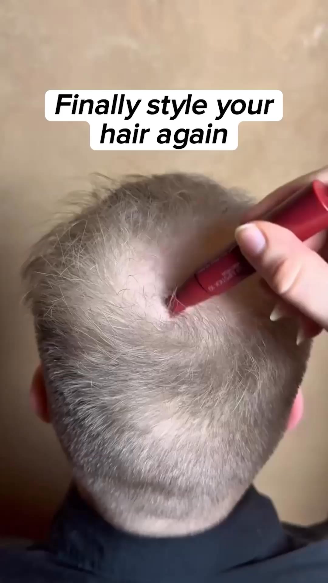 Beat Hairloss Today