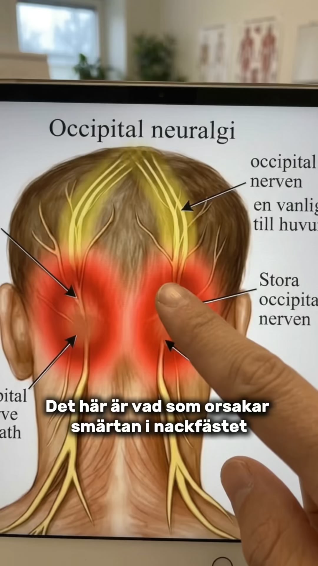 Lindra smärtan i nacken