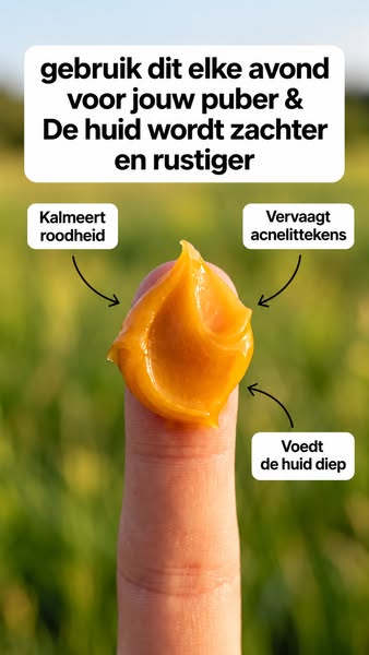Stop Acne - Bespaar 50%