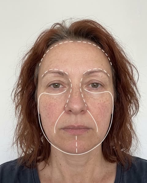 Dermatolog mnie zbył… wielki błąd