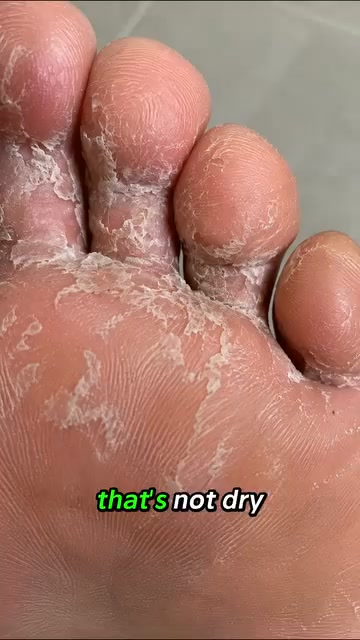 Why Your Foot Cream Keeps Failing