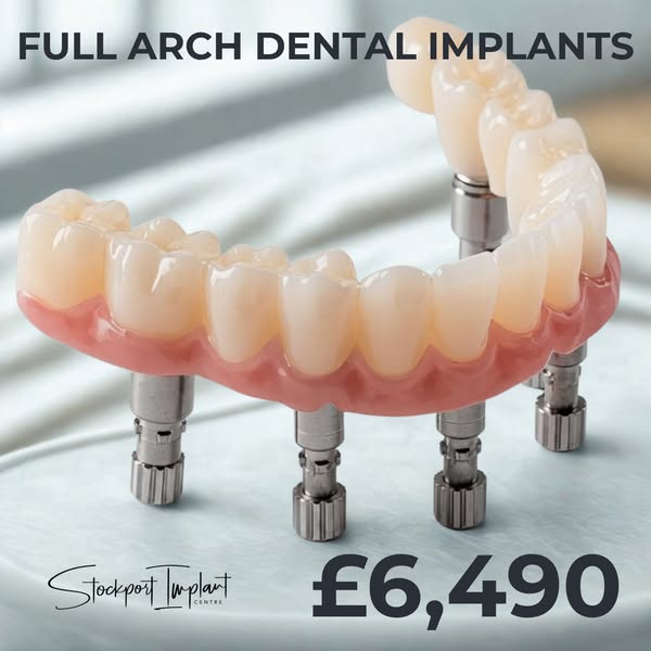 Full Arch Dental Implants From £6,490