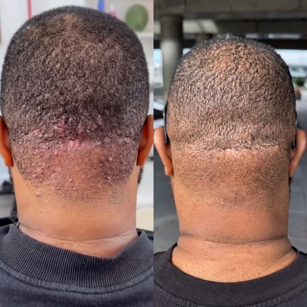 Real Formula. Real Results. Black Men Get It.