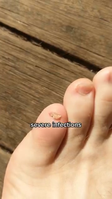 The Real Reason You’re Hiding Feet