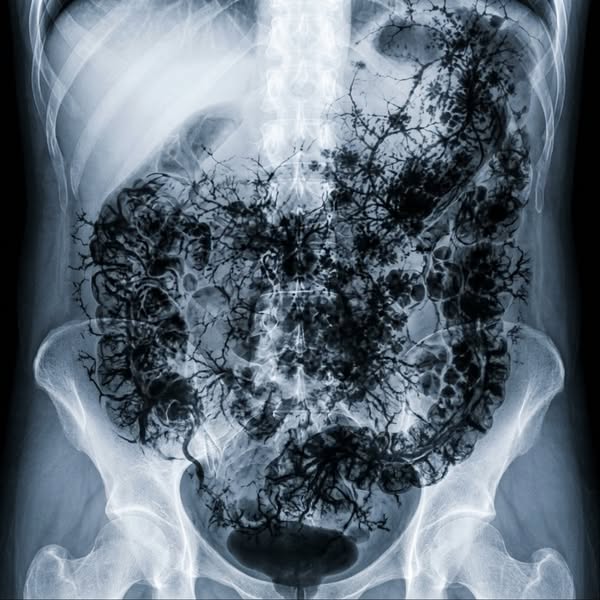 Support Healthy Digestion Naturally