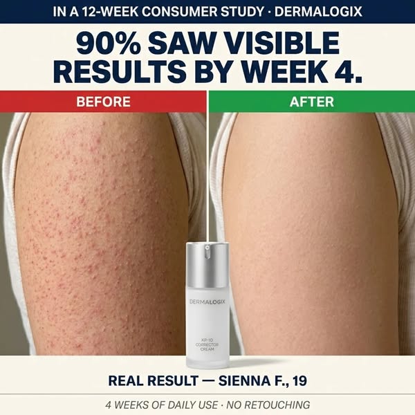 90% saw visible results by week 4