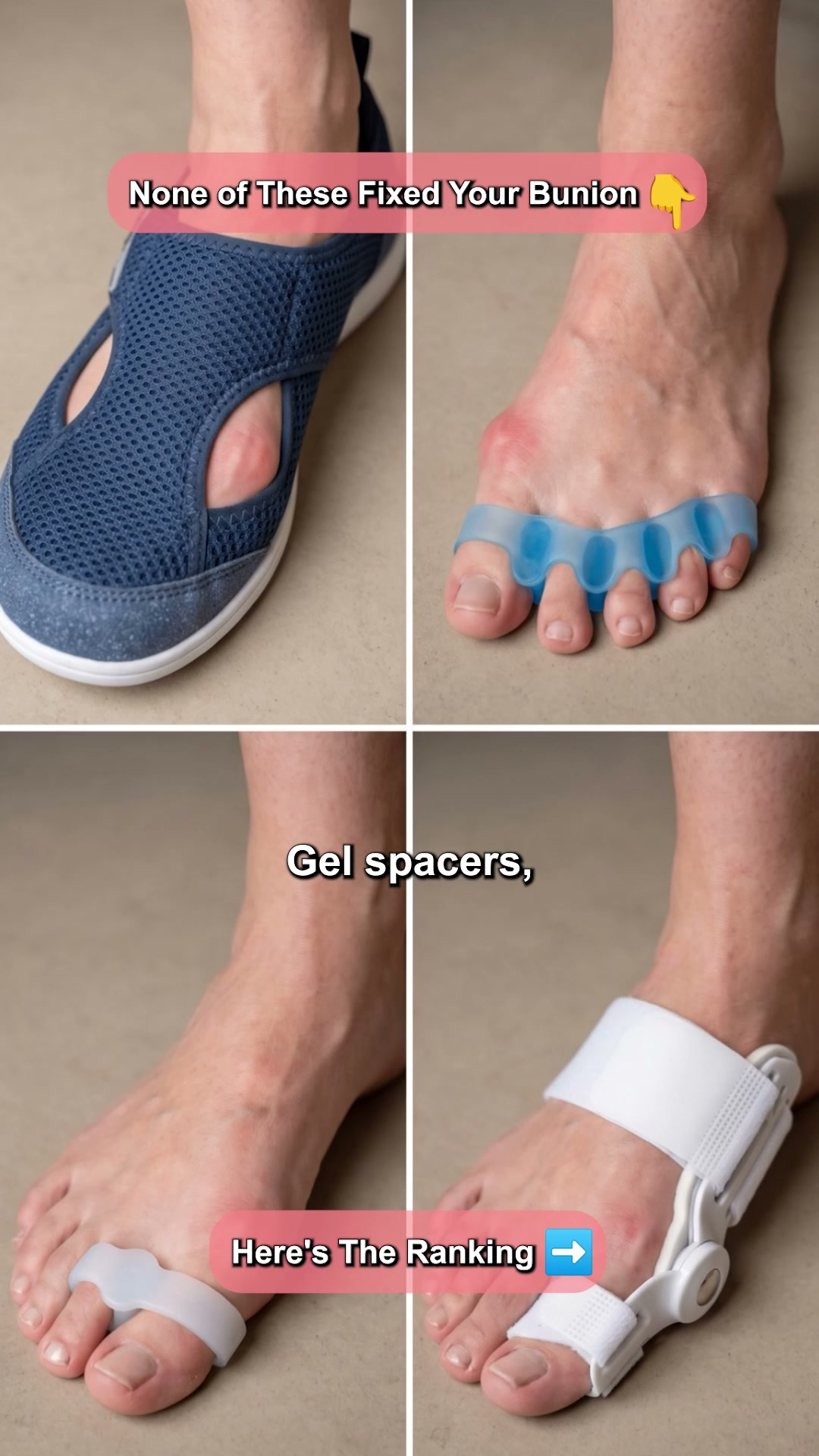 Stop Wasting Money on Bunion Correctors