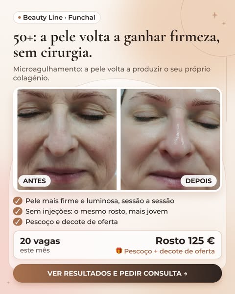 Resultados reais e consulta grátis
