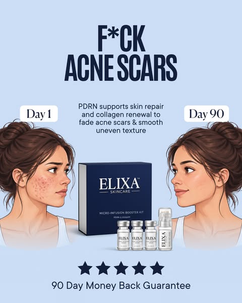 Learn the benefits of PDRN for Acne Scars