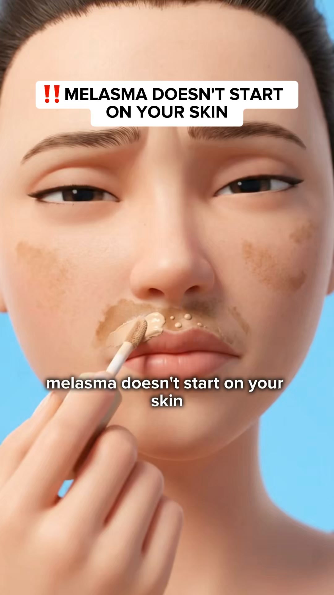 Stop Covering Melasma With Makeup, Do This Instead
