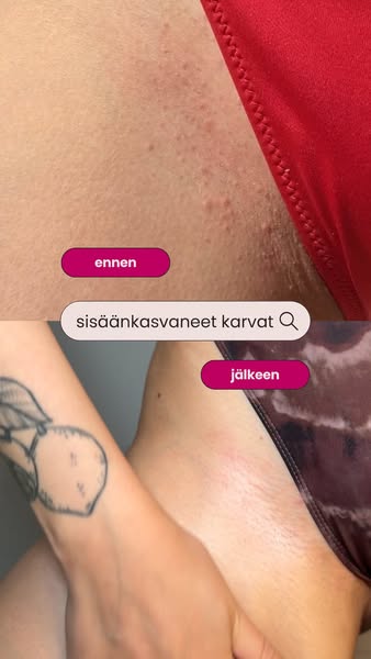 Päivitä sun sheivausrutiini