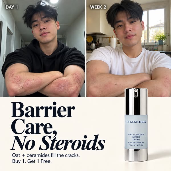 Barrier care for eczema-prone skin