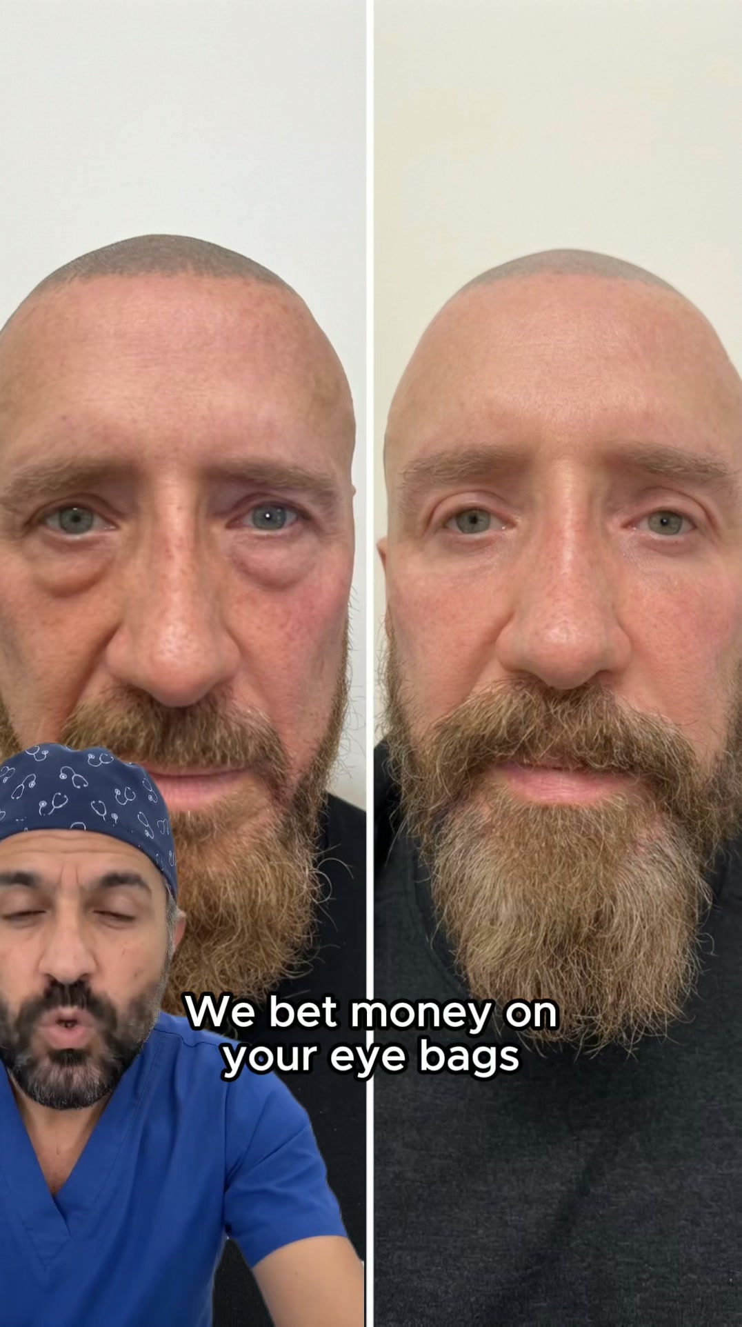 We bet money on your eye bags