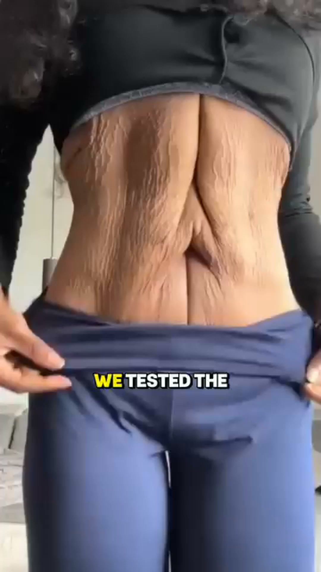 The protein collagen can't replace.
