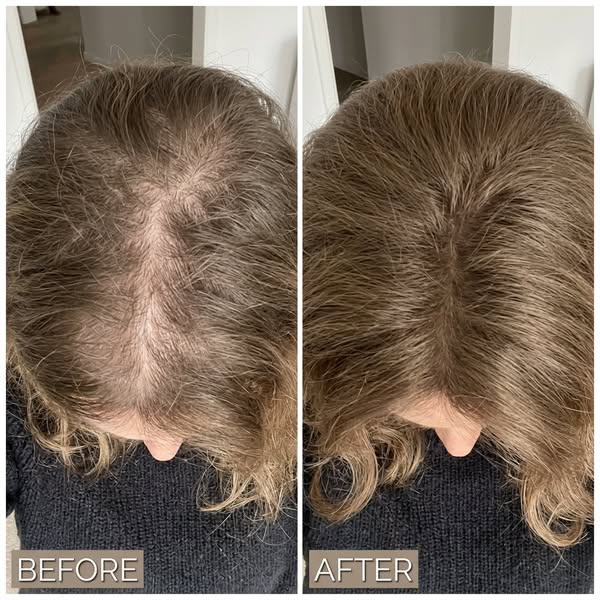 My hair changed completely