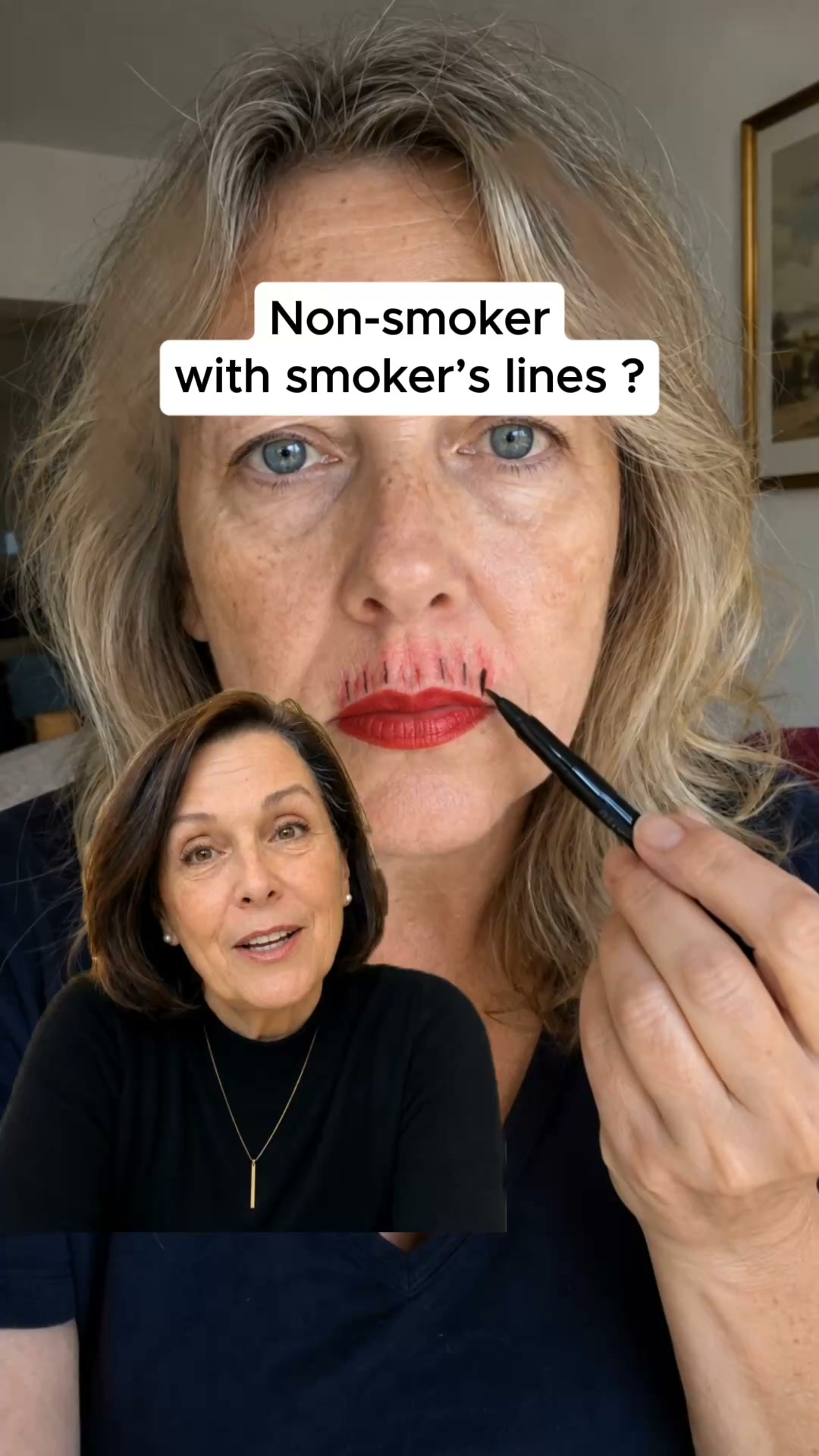 No More Lip Lines