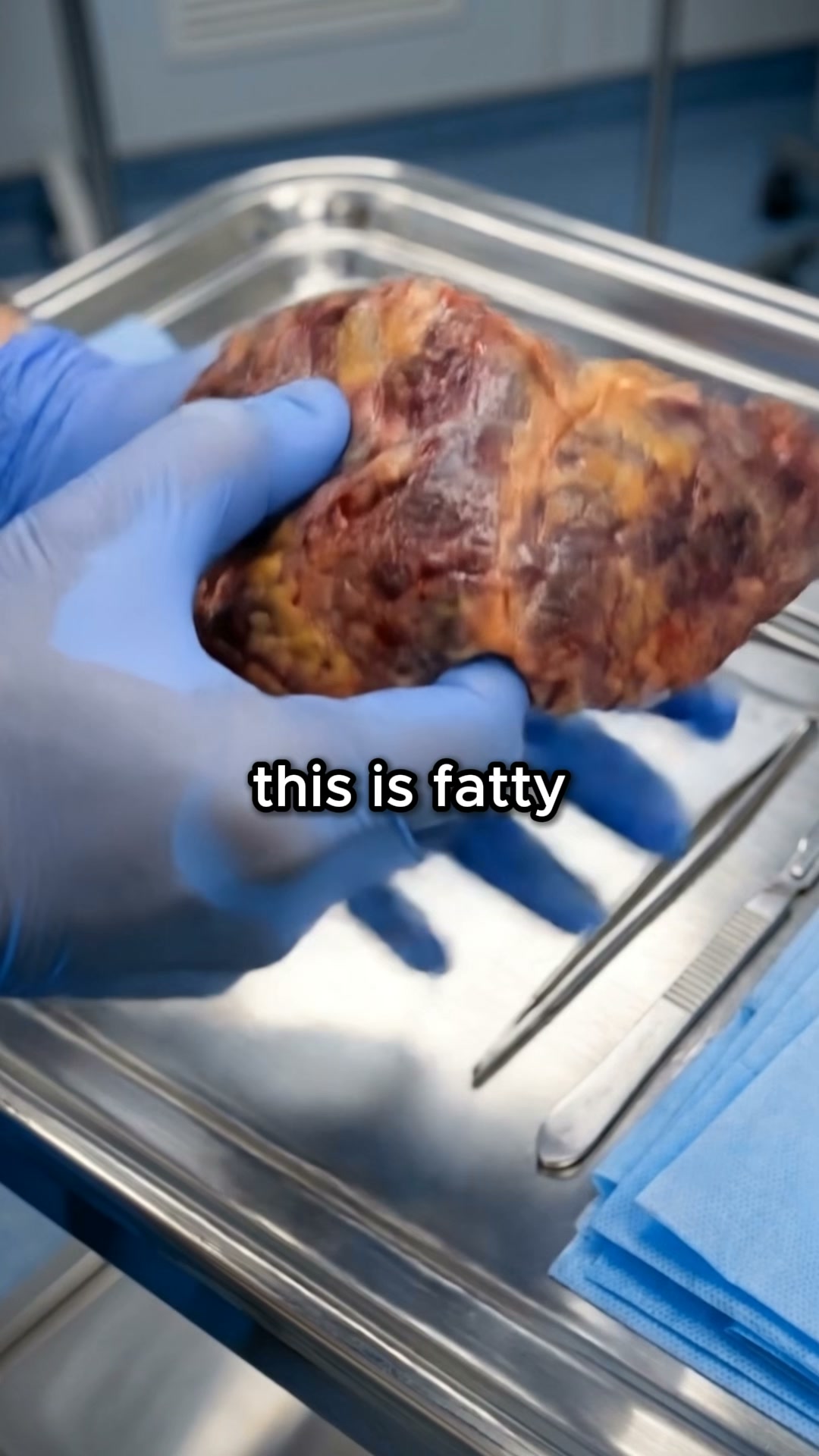 Restore Your Liver In 90 Days