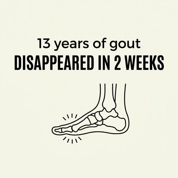 Allopurinol can help stop new uric acid being made — but it does nothing for the crystals already lodged in your joints.