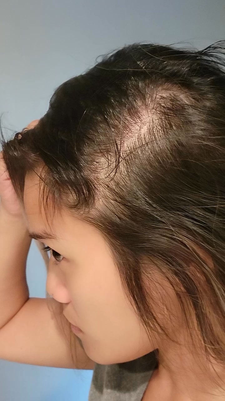 Shop The Scalp Treatment
