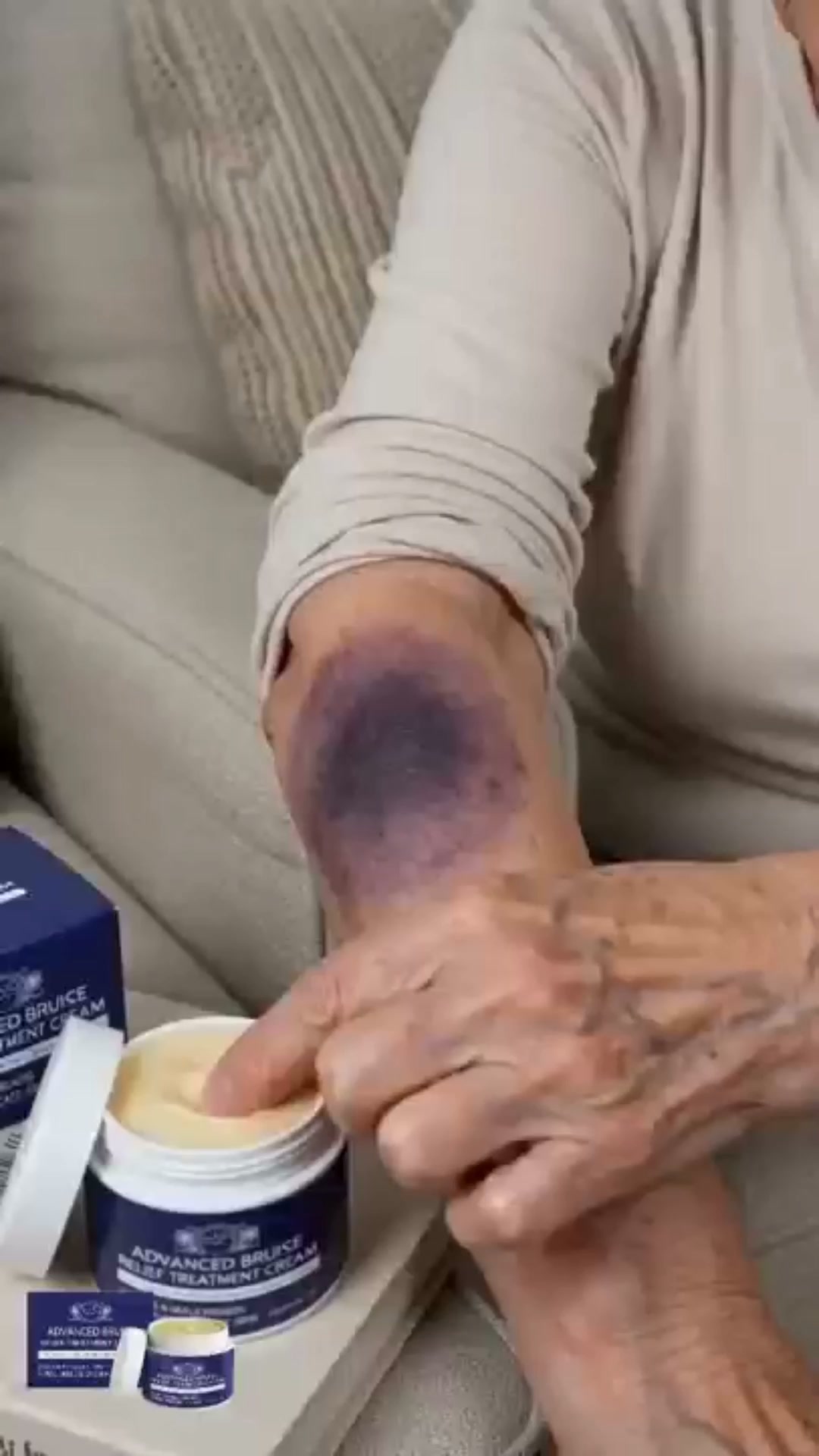 The Truth About "Miracle" Bruise Creams