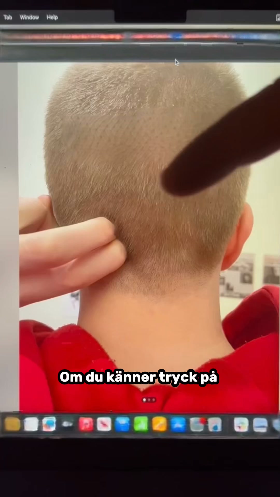 Lindra smärtan i nacken