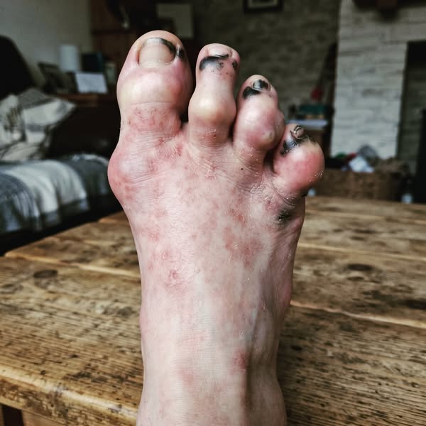 Soulagement de la douleur