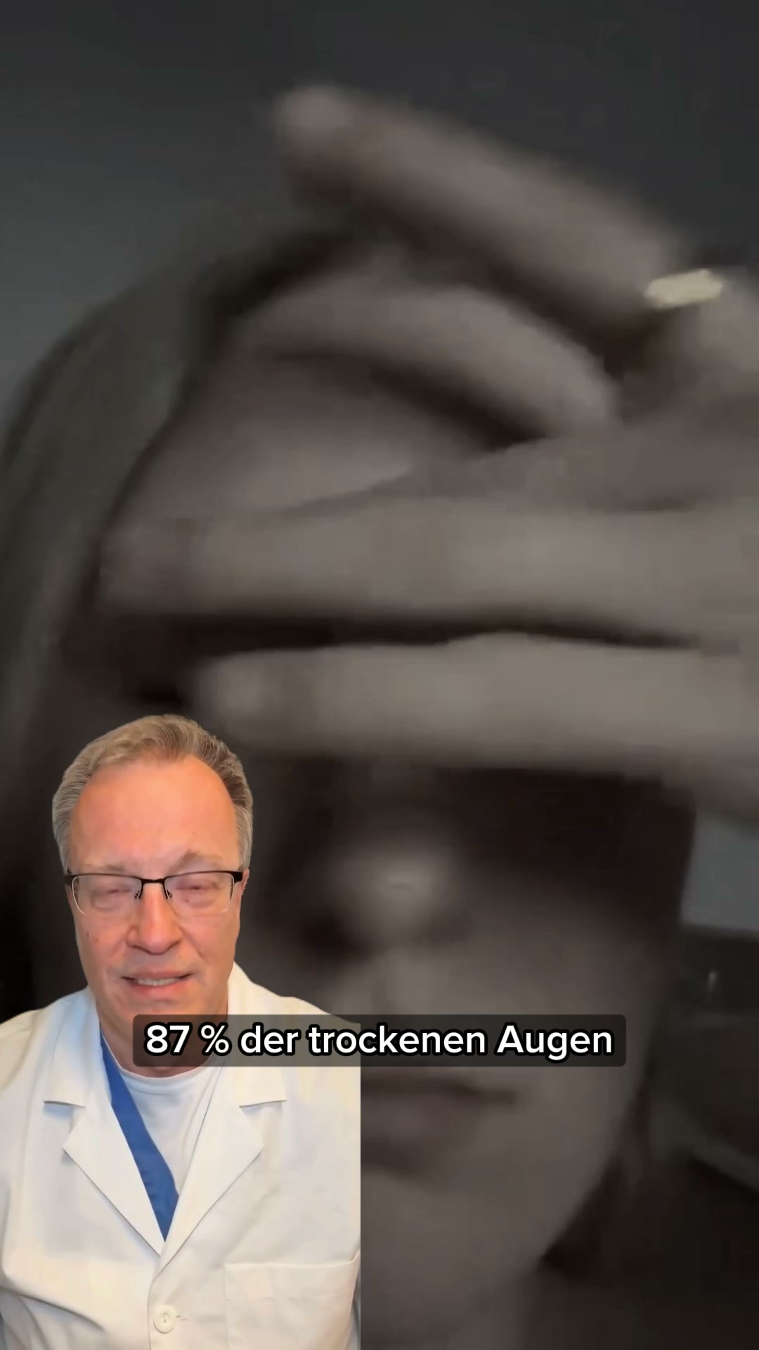 Trockene Augen lösen