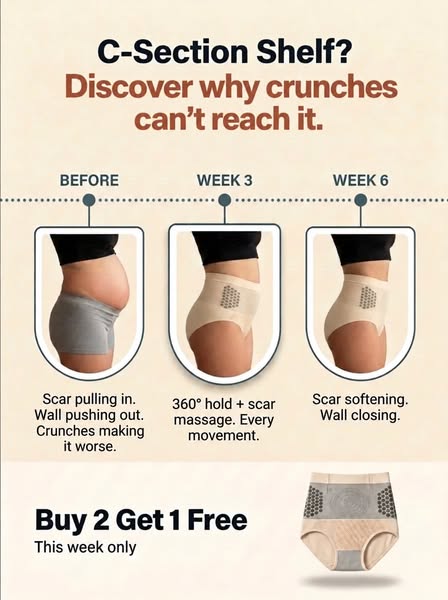 Why your c section shelf won't leave.