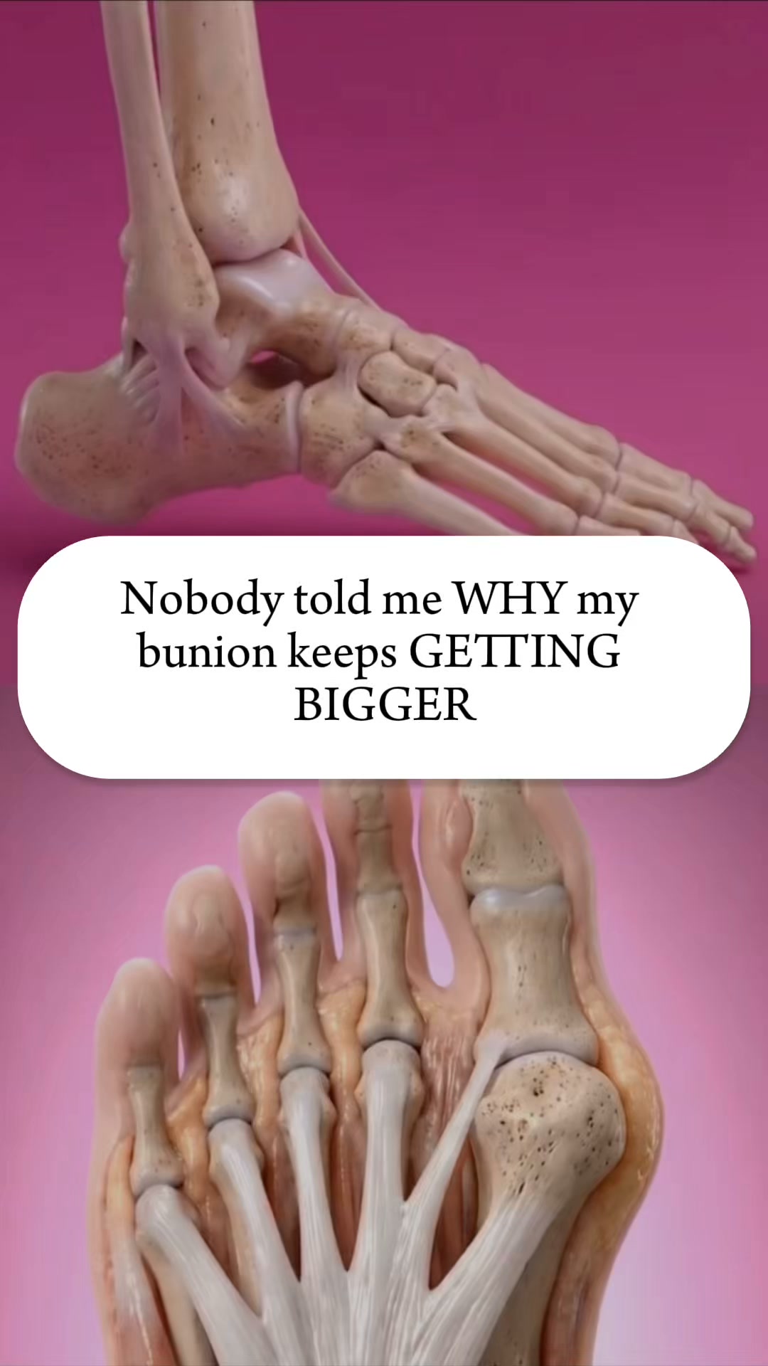 Told to "Wait Until Surgery"? Read This First.