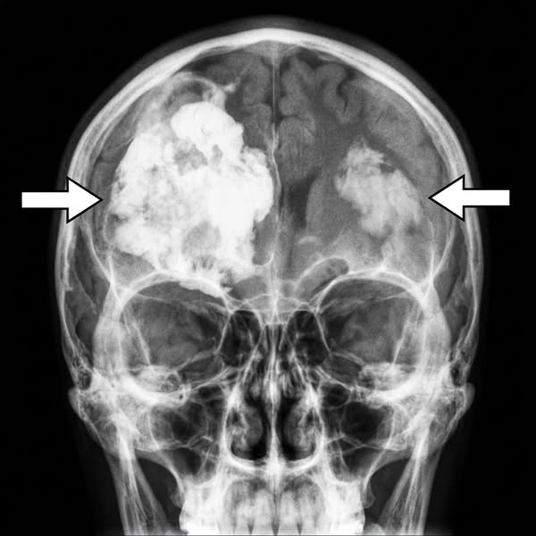 Protect your brain before it's too late